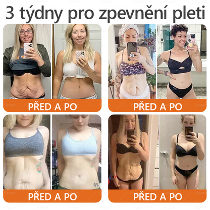 👨‍⚕‍Sinvie® Krém na obnovu pleti s včelím jedem CE schváleno,Přírodní složky trvale odstraňují skvrny, pihy a sluneční skvrny, bojují proti vráskám a povolené pokožce — 50 ml🐝🐝