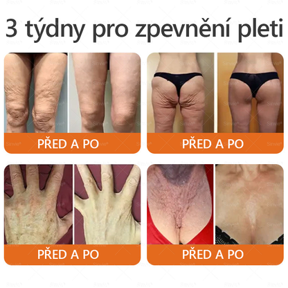 👨‍⚕‍Sinvie® Krém na obnovu pleti s včelím jedem CE schváleno,Přírodní složky trvale odstraňují skvrny, pihy a sluneční skvrny, bojují proti vráskám a povolené pokožce — 50 ml🐝🐝