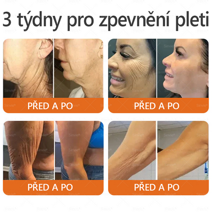 👨‍⚕‍Sinvie® Krém na obnovu pleti s včelím jedem CE schváleno,Přírodní složky trvale odstraňují skvrny, pihy a sluneční skvrny, bojují proti vráskám a povolené pokožce — 50 ml🐝🐝