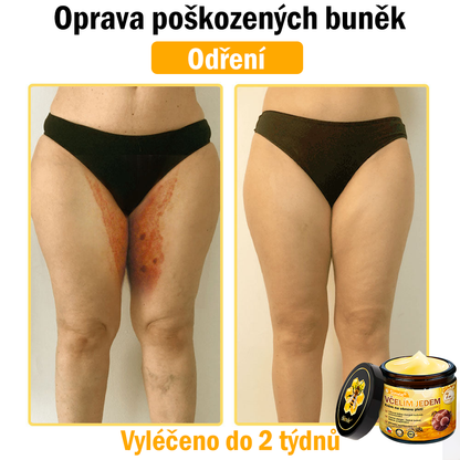 👨‍⚕‍Sinvie® Krém na obnovu pleti s včelím jedem CE schváleno,Přírodní složky trvale odstraňují skvrny, pihy a sluneční skvrny, bojují proti vráskám a povolené pokožce — 50 ml🐝🐝
