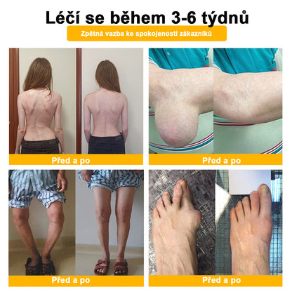 🎁 StawVital® regenerační krém na klouby a kosti s obsahem botoxu a včelího jedu Cílená péče při ortopedických problémech a bolestech kloubů 🎁