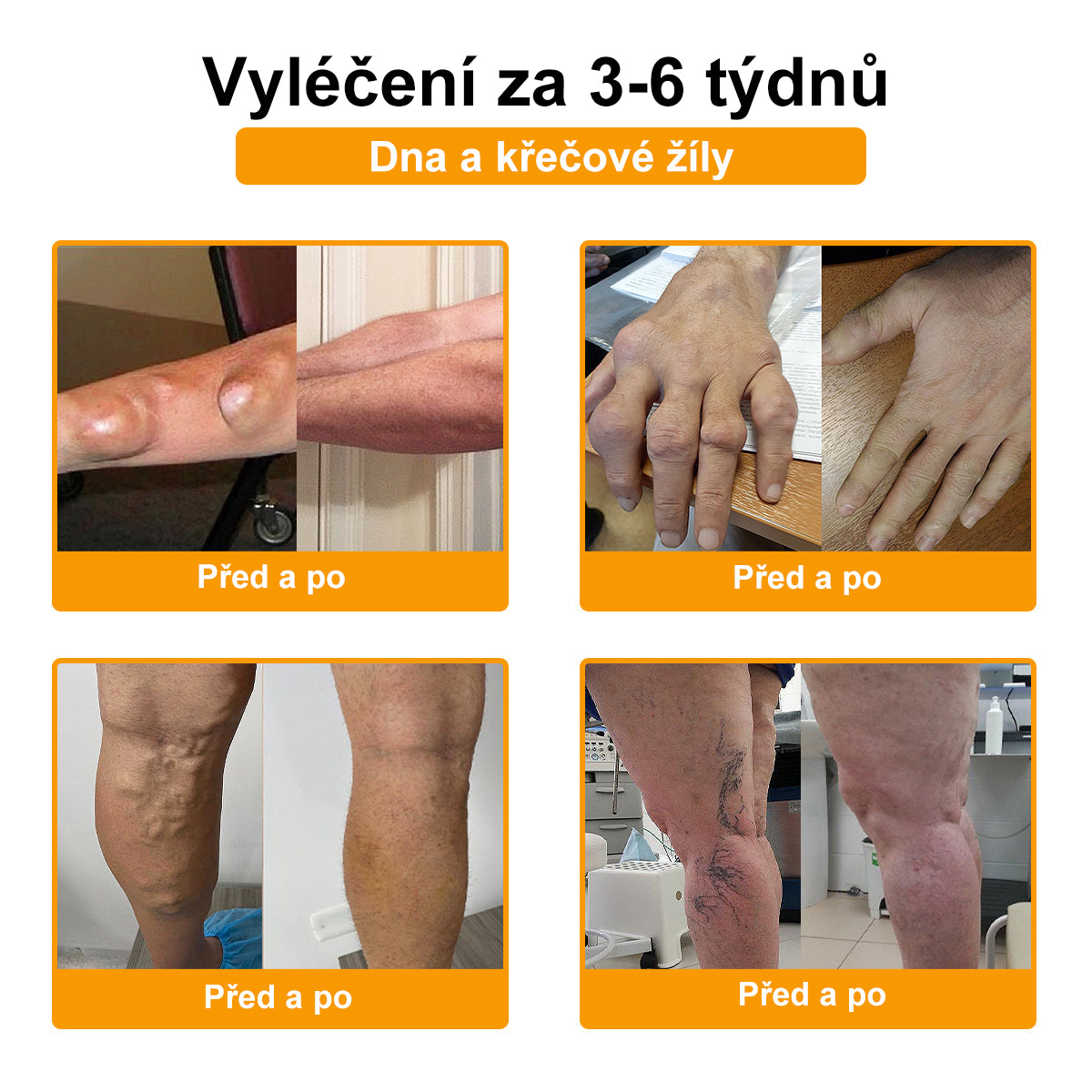 🎁 StawVital® regenerační krém na klouby a kosti s obsahem botoxu a včelího jedu Cílená péče při ortopedických problémech a bolestech kloubů 🎁