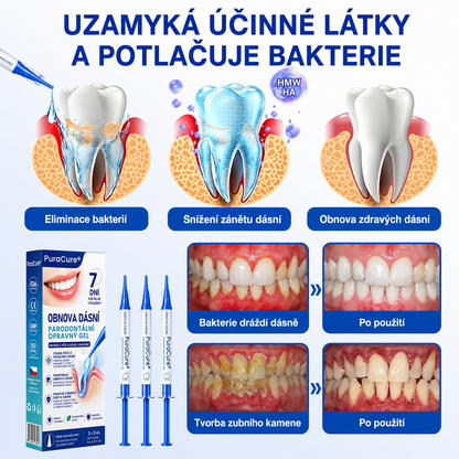 🦷 𝐏𝐮𝐫𝐚𝐂𝐮𝐫𝐞®  𝐎𝐛𝐧𝐨𝐯𝐚 𝐝á𝐬𝐧í 𝐩𝐚𝐫𝐨𝐝𝐨𝐧𝐭á𝐥𝐧í 𝐨𝐩𝐫𝐚𝐯𝐧ý 𝐠𝐞𝐥 ✨