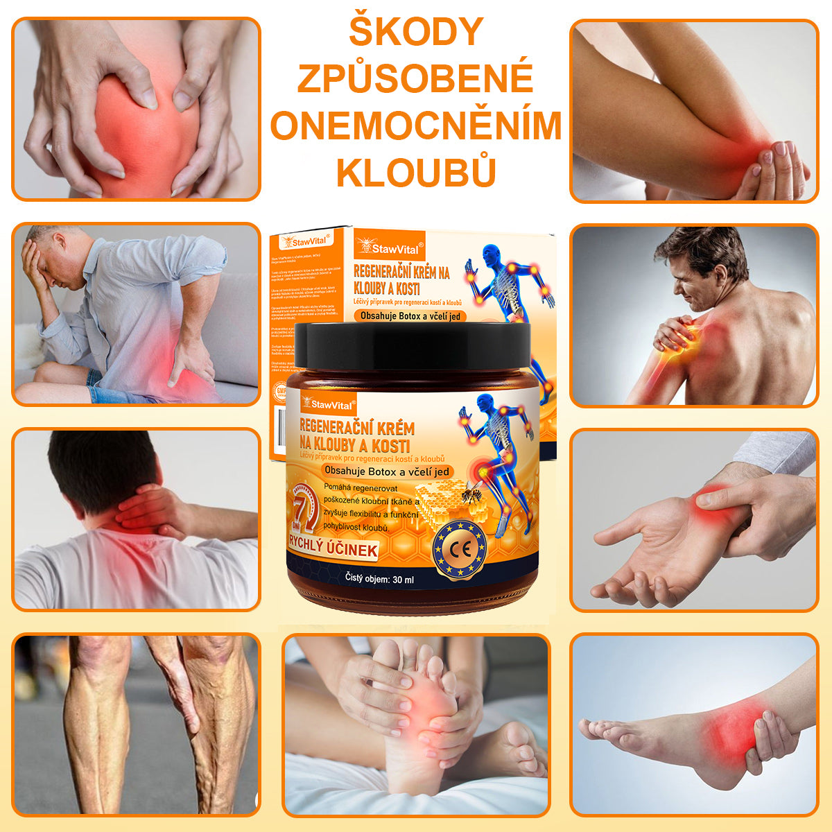 🎁 StawVital® regenerační krém na klouby a kosti s obsahem botoxu a včelího jedu Cílená péče při ortopedických problémech a bolestech kloubů 🎁