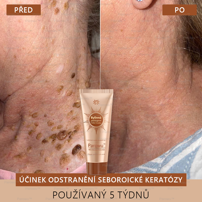 🎁Parowu™ Bělící a Odstraňující Skvrny Maska -🍀Přírodní složky trvale odstraňují pigmentové skvrny, stařecké skvrny, pihy a sluneční skvrny 🎁