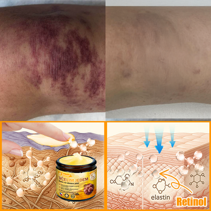 👨‍⚕‍Sinvie® Krém na obnovu pleti s včelím jedem CE schváleno,Přírodní složky trvale odstraňují skvrny, pihy a sluneční skvrny, bojují proti vráskám a povolené pokožce — 50 ml🐝🐝