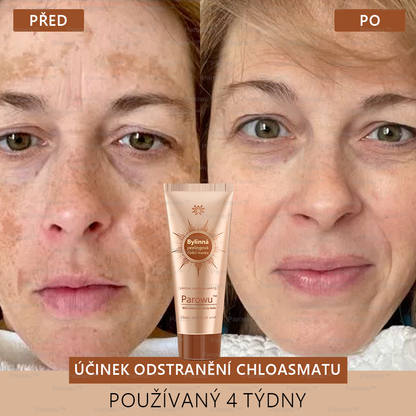 🎁Parowu™ Bělící a Odstraňující Skvrny Maska -🍀Přírodní složky trvale odstraňují pigmentové skvrny, stařecké skvrny, pihy a sluneční skvrny 🎁