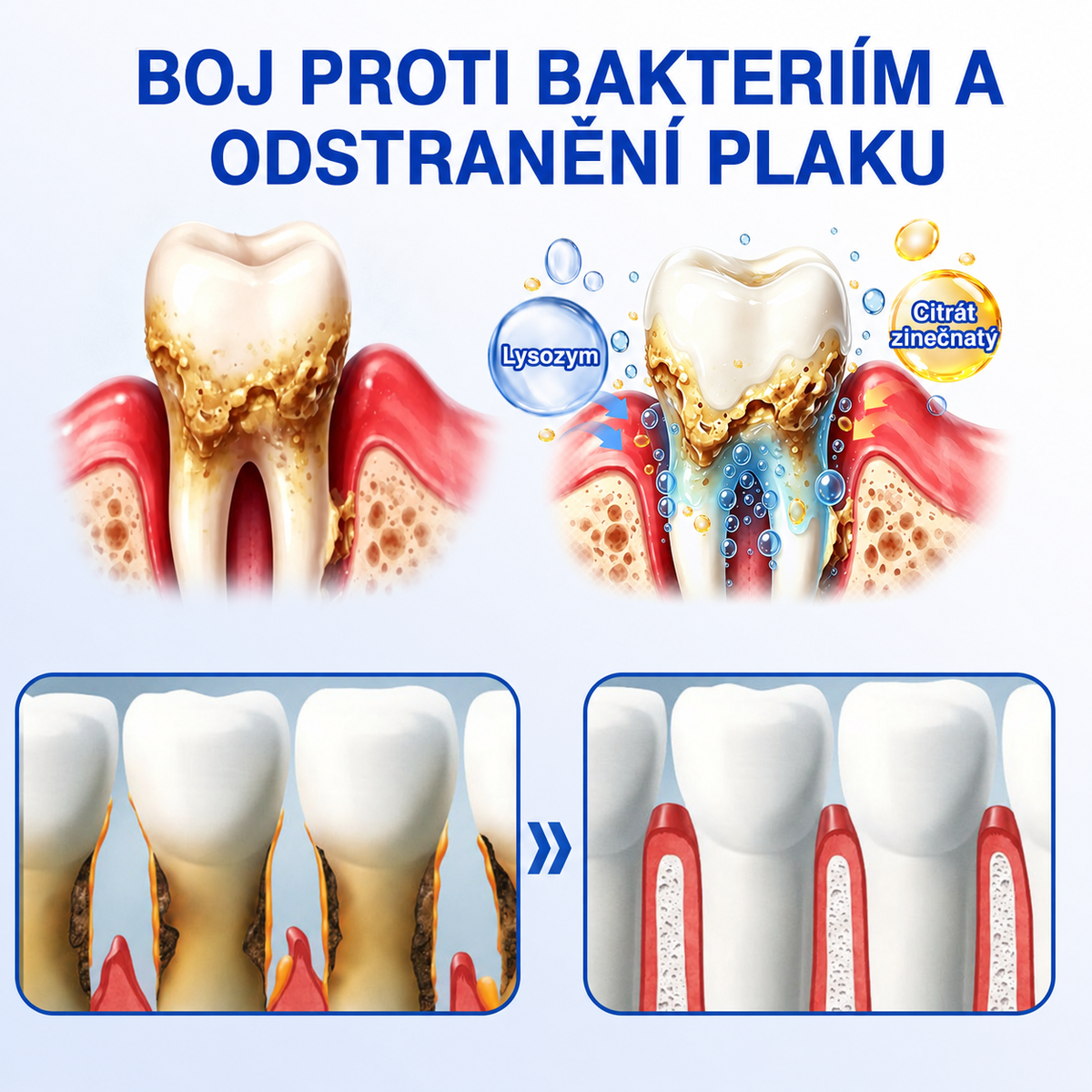 🦷 𝐏𝐮𝐫𝐚𝐂𝐮𝐫𝐞®  𝐎𝐛𝐧𝐨𝐯𝐚 𝐝á𝐬𝐧í 𝐩𝐚𝐫𝐨𝐝𝐨𝐧𝐭á𝐥𝐧í 𝐨𝐩𝐫𝐚𝐯𝐧ý 𝐠𝐞𝐥 ✨