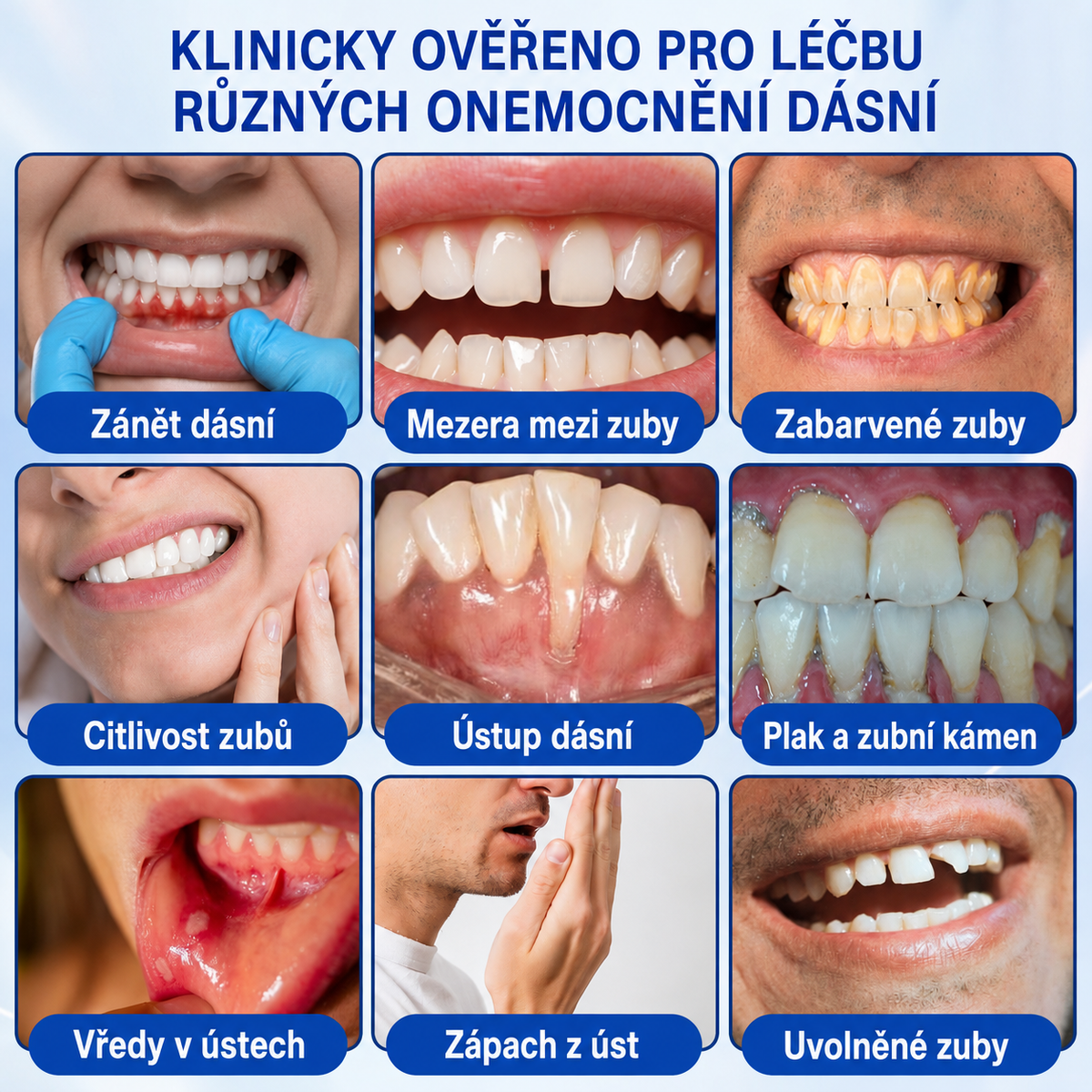🦷 𝐏𝐮𝐫𝐚𝐂𝐮𝐫𝐞®  𝐎𝐛𝐧𝐨𝐯𝐚 𝐝á𝐬𝐧í 𝐩𝐚𝐫𝐨𝐝𝐨𝐧𝐭á𝐥𝐧í 𝐨𝐩𝐫𝐚𝐯𝐧ý 𝐠𝐞𝐥 ✨