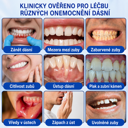 🦷 𝐏𝐮𝐫𝐚𝐂𝐮𝐫𝐞®  𝐎𝐛𝐧𝐨𝐯𝐚 𝐝á𝐬𝐧í 𝐩𝐚𝐫𝐨𝐝𝐨𝐧𝐭á𝐥𝐧í 𝐨𝐩𝐫𝐚𝐯𝐧ý 𝐠𝐞𝐥 ✨